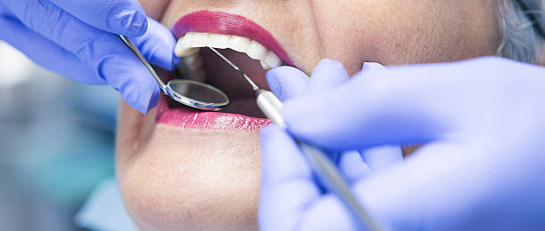 Best Emergency Root Canal Therapy in Caruthersville, MO